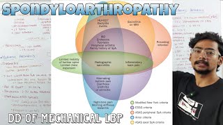 Introduction to SPONDYLOARTHRITIS  Rheumatology [upl. by Oby]