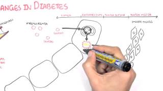 Diabetes Complication and Pathophysiology of the complication [upl. by Black]