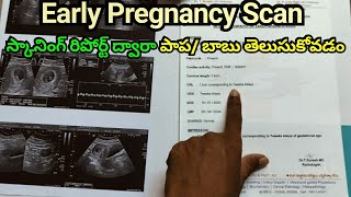 Early Pregnancy Scan  How To Read Pregnancy Scan Report  Pregnancy Scan  Pregnancy Journey [upl. by Bilat83]