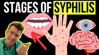 Doctor explains the Symptoms and Stages of SYPHILIS STI [upl. by Nnadroj]