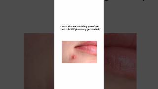 50₹ gel for acne goviral skincare trending viralvideo shorts youtubeshorts [upl. by Akined799]