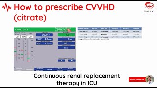 Continous renal replacement therapy in ICU [upl. by Corinne541]