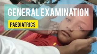 general examination paediatrics  paediatrics ward  general examination  sanowarhossain1290 [upl. by Esdras401]