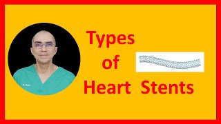 Types of Stents [upl. by Cariotta]