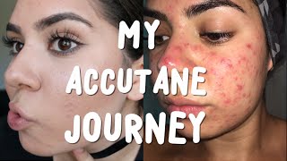 Accutane Week 1  Starting Accutane amp My Acne Journey [upl. by Analart]