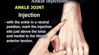 Common Foot And Ankle Injections  Everything You Need To Know  Dr Nabil Ebraheim [upl. by Lipfert907]