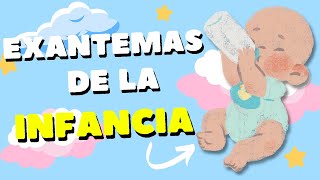 Exantemas de la Infancia ¡FÁCIL Y RÁPIDO [upl. by Leontine181]