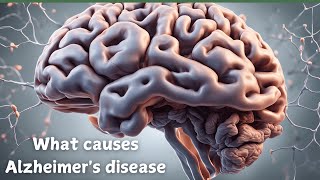 quotUnderstanding Alzheimer’s Causes Risks and Hope for a Cure [upl. by Eicats307]