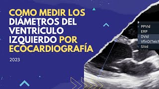 📌Como medir 📏 DIAMETROS DEL VENTRÍCULO IZQUIERDO por ECOCARDIOGRAFÍA [upl. by Ydnew635]