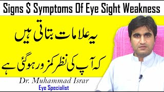 Signs And Symptoms Of Weak EyeSight [upl. by Chandless]