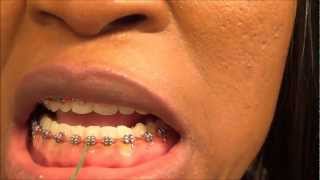 106 HOW TO USE THE DENTAL TAPE  FLOSSING WITH DENTAL TAPE [upl. by Perlis]