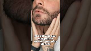 Comment faire pousser sa barbe plus vite avec l’huile de ricin [upl. by Aleehs]