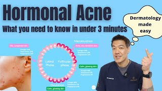 Hormonal acne explained in under 3 minutes  Dermatologist reviews [upl. by Enrobso]