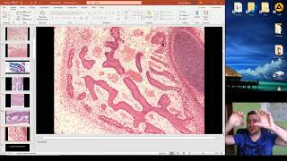 Histology of the Ossification part 1 [upl. by Durning]