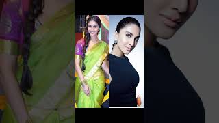 btown celebrity before amp after botox filler jacqueline amyjackson bollywood vaani priyanka [upl. by Sari]