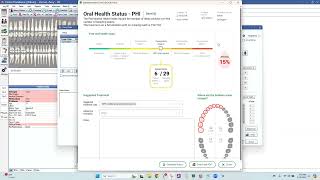 Voice Enabled Perio Charting amp PHI Reporting for Open Dental with Denti AI Voice [upl. by Kcirddec]