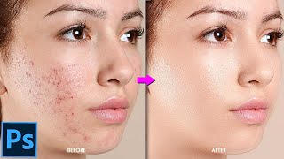 Secret Trick to Repair Blotchy Skin in Photoshop I HighEnd Skin Retouch I Face Smooth in Photoshop [upl. by Oivat212]