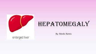 Hepatomegaly  causes pathophysiology [upl. by Clint510]