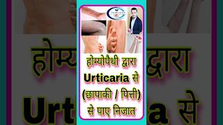 होम्योपैथी द्वारा Urticaria सेछापाकी पित्ती से पाए निजात shorts youtubeshorts short urticaria [upl. by Lisette]