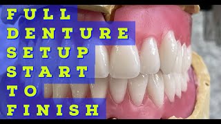 Full Denture Setup From Start To Finish [upl. by Hume]