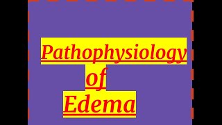 PATHOLOGY OF EDEMA [upl. by Barna]