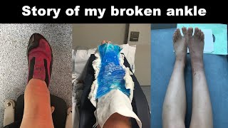 Story of my broken ankle  Trimalleolar ankle fracture [upl. by Enahc]