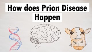 Prion Disease  How does Prion Disease Happen [upl. by Pelaga]