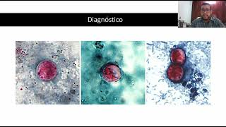 20 Cyclospora cayetanensis [upl. by Illehs]