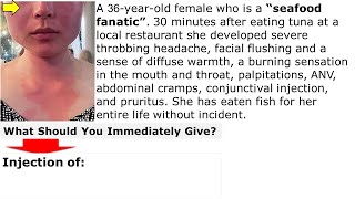 Reaction after eating fish What is your treatment Q CME internalmedicine محاضراتباطنة [upl. by Ivonne]