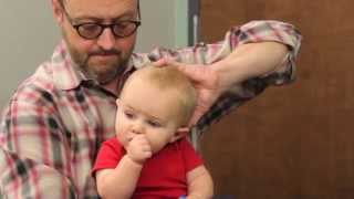 Treatment for Plagiocephaly [upl. by Adore]