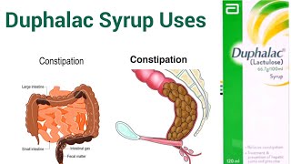 duphalac dry uses  duphalac syrup uses  duphalac  uses in urdu Hindi [upl. by Fassold]