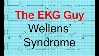 Wellens Syndrome  EKGECG Course 1200  The EKG Guy  wwwekgmd [upl. by Goggin]