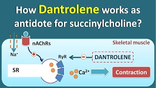 How Dantrolene works as antidote for Succinylcholine [upl. by Rucker546]