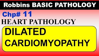 Chp11 Robbins Patho  Heart Pathology  DILATED Cardiomyopathy  Dr Asif Lectures [upl. by Blanchette]