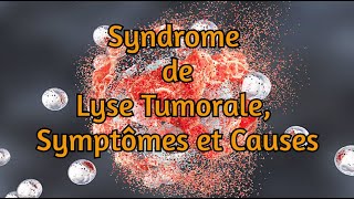 Syndrome de lyse tumorale symptômes et causes [upl. by Diane]