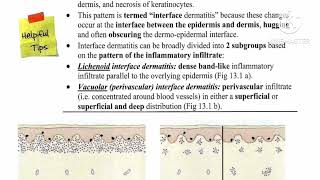 1 Lichenoid Review ✅ Lichen planus 🔸 Lichenoid drug eruption by Dr Ahmed Kamel [upl. by Wolsniw]