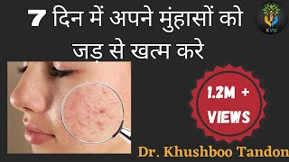 7 दिन में Pimples  Acne को जड़ से खत्म करें  Home Remedies For PimplesAcne in Hindi [upl. by Elocan855]