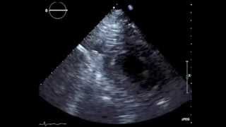 Transthoracic Echocardiography [upl. by Alanson]