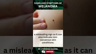 Signs and Symptoms of Melanoma shorts [upl. by Brandtr]