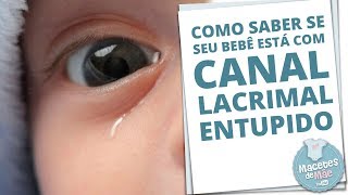 CANAL LACRIMAL ENTUPIDO E COMO TRATAR A OBSTRUÇÃO  MACETES DE MÃE [upl. by Enirehs659]