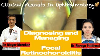 Toxoplasma RetinochoroiditisCase discussion for Ophthalmologists Residents trainees and students [upl. by Maximilien]