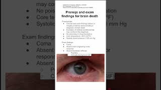 Prereqs and exam findings for brain death [upl. by Nirrat]