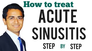 Acute Sinusitis Treatment Bacterial Vs Viral Symptoms Diagnosis ENT Medicine Lecture USMLE [upl. by Yhtak684]