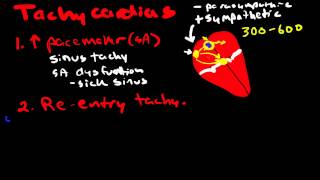 Pathophysiology of Cardiac Arrhythmias [upl. by Anbul]