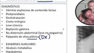 8 ESTENOSIS HIPERTROFICA DE PILORO [upl. by Enialedam]