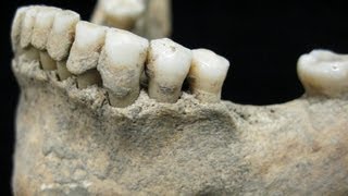 Dental calculus ancient diets revealed [upl. by Hayifas]