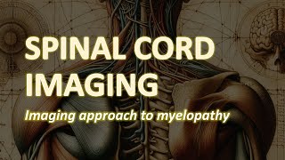 Spinal Cord Imaging Imaging approach to Myelopathy [upl. by Deron]