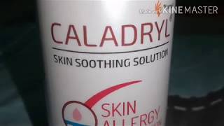 Caladryl skin lotion review in tamil  uses  sideeffects [upl. by Leahey]