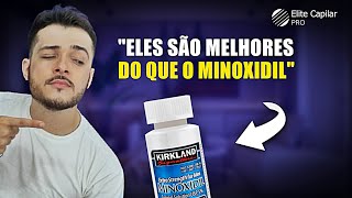 SUBSTITUTOS NATURAIS DO MINOXIDIL  Aula 62 [upl. by Arlon]