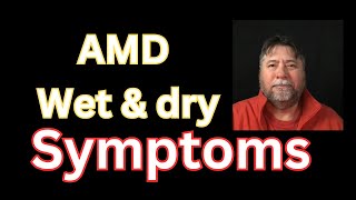 😎 Macular Degeneration Symptoms AMD Wetb amp Dry [upl. by Taima486]